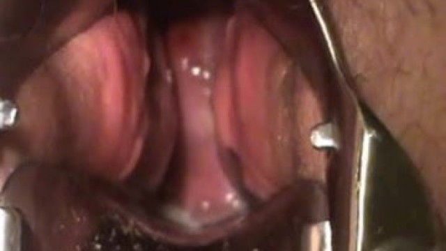 bbw masturbate with speculum show cervix contracting orgasm